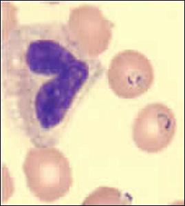 20110306-malaria cdc  clip_image001_0003.jpg
